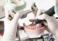 The art of creating perfect dental appliances: a guide to dental laboratory techniques