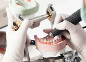 The art of creating perfect dental appliances: a guide to dental laboratory techniques