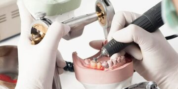 The art of creating perfect dental appliances: a guide to dental laboratory techniques