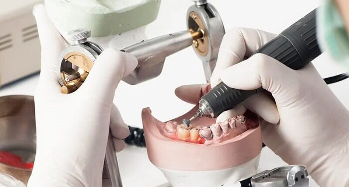 The art of creating perfect dental appliances: a guide to dental laboratory techniques