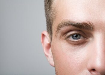 What is eyebrow transplant, and why is Turkey so affordable