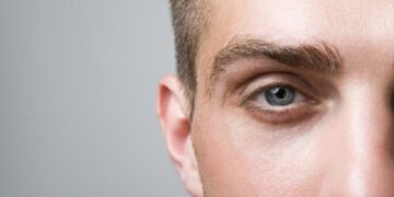 What is eyebrow transplant, and why is Turkey so affordable